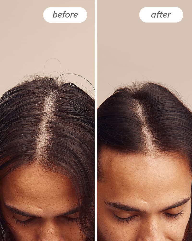 Instant Relief™ Duo - Image 5