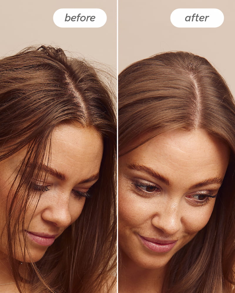 Scalp Delight™ Detox Scrub - Image 4